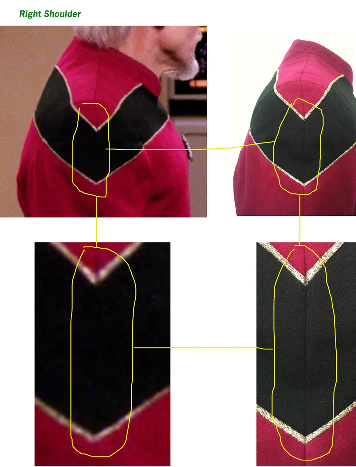 gallery-1right-shoulder