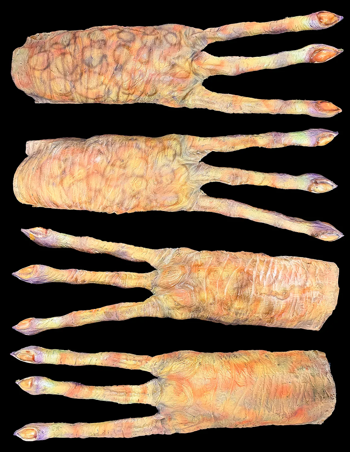 Barash’s Hands